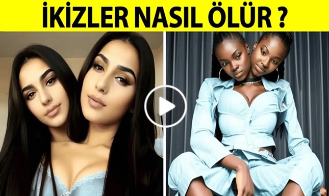 Yapışık İkizler Nasıl Yaşar Nasıl Ölürler?